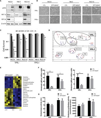 Decrease of Intracellular Glutamine by STF-62247 Results in the Accumulation of Lipid Droplets in von Hippel-Lindau Deficient Cells